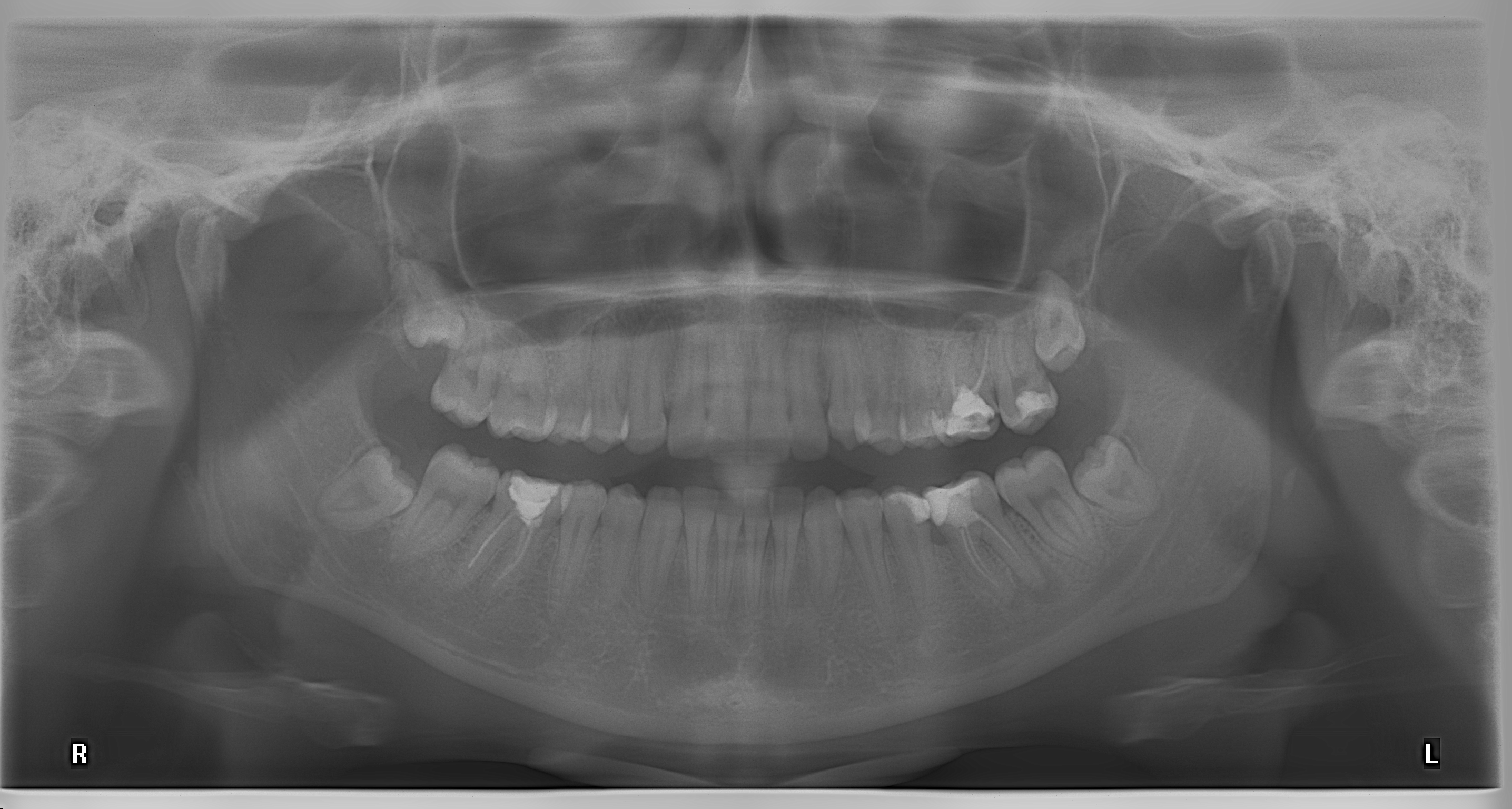 radiografie